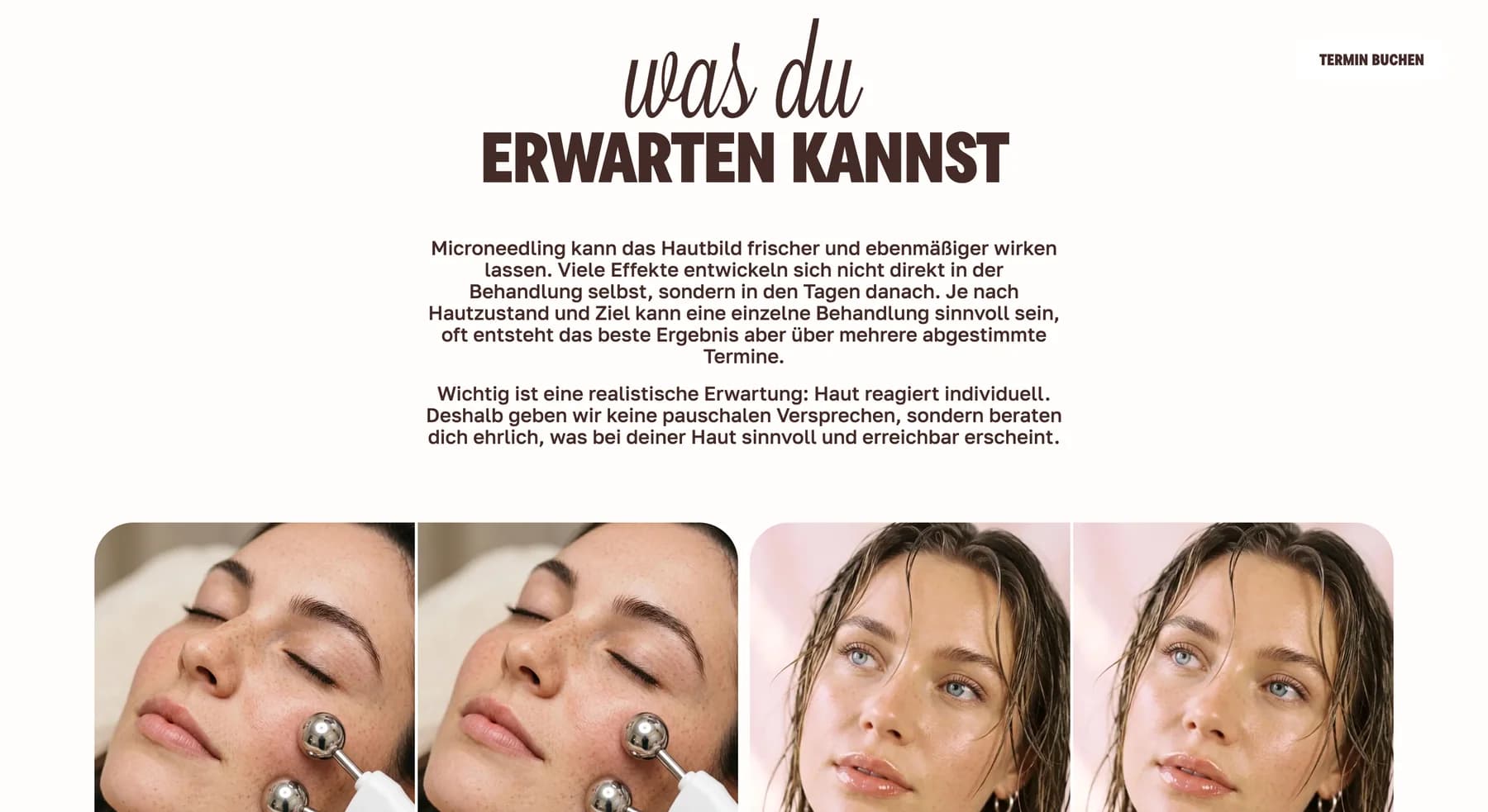 Microneedling editorial section with portrait photography